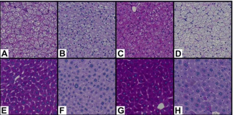 Figure 3. Histological visualization of glycogen storage in IBAT (top row) and liver (bottom row) using Periodic Acid Schiff staining.