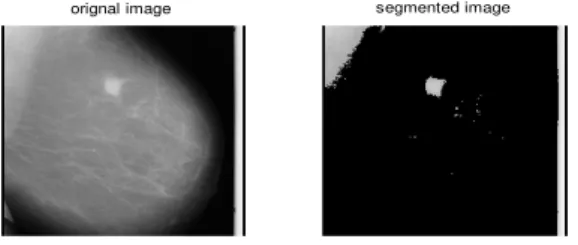 Fig 3: a) Orignal Image b) Thresholded image 