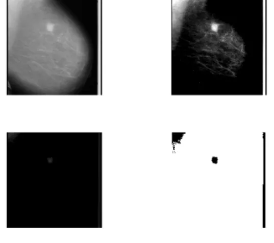 Fig 4:- Contrast Enhancement 