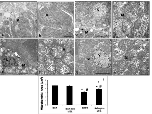 Figure 2. Transmission electron microscopy. Ultrastructural photomicrographs showing cortical proximal tubules and mitochondria of lean (a, b), lean mice treated with melatonin (c, d), ob/ob (e, f) and ob/ob treated with melatonin mice (g, h)