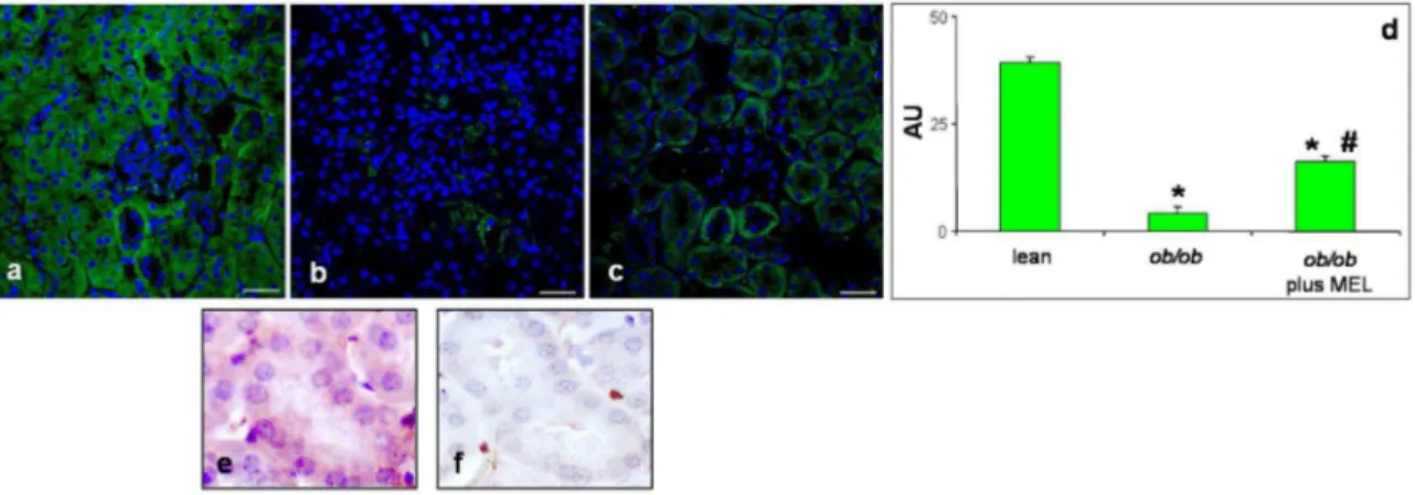 Figure 4. Apoptotic markers immunofluorescence assay. Photomicrographs of immunofluorescence analyses of kidney cytochrome c (green staining) of lean (a), ob/ob (b) and ob/ob treated with melatonin (c) mice