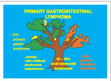Abbildung 1: Primäre gastrointestinale Lymphome sind zu 70 % im Ma- Ma-gen und zu 30 % im Intestinum lokalisiert