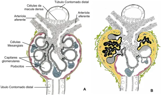 Figura 2. Representação esquemática de (A) glomérulo normal, (b) glomérulo esclerótico