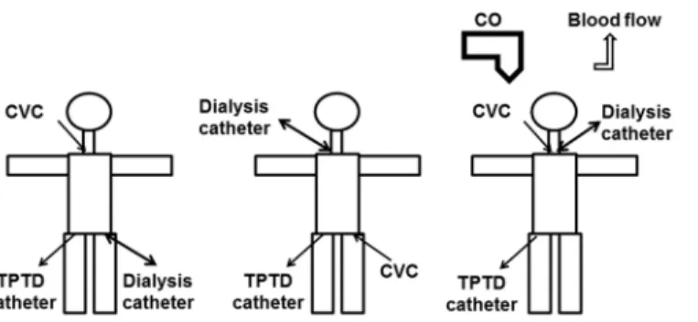 Fig 1. Potential impact of renal replacement therapy (RRT) on transpulmonary thermodilution (TPTD) with potential impact of catheter positions and blood flow.