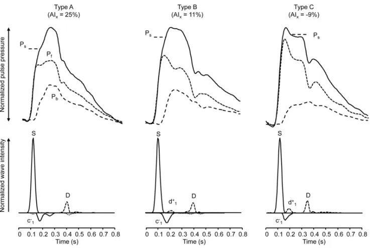 Table 3. Comparison of measures of reflection between type A, B and C waveforms.