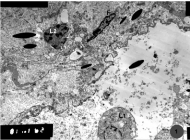 Fig. 4: Transmission electron micrograph of the testicular interstitial  tissue showing, Leydig cells (L) with myelin figures (arrows), blood  vessel (Bv): Winter season  (Mic