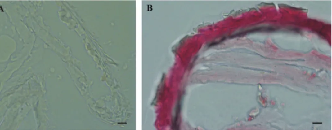 Figure 6. Histochemical reaction for calcium – Alizarin red S. A No reaction in P. scaber late marsupial  manca B Positive control (red-pink) in adult P