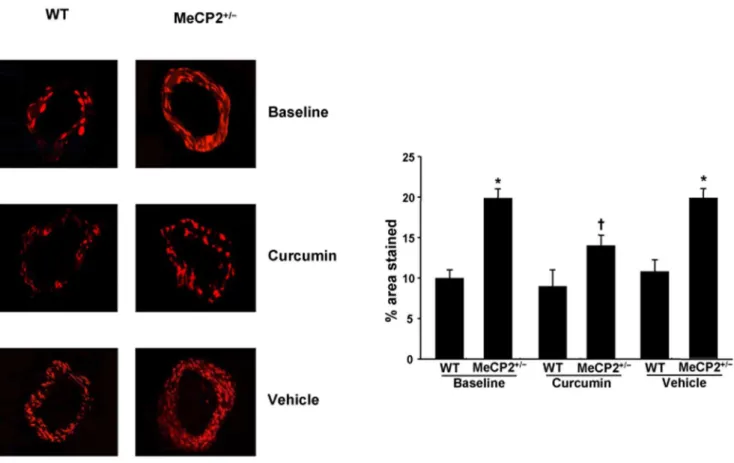 Figure 3. Superoxide anion generation: DHE staining and quantification. Representative DHE staining and quantification (bar graph) of the red signal in mesenteric arteries (magnification X 40) from WT and MeCP2 +/2 mice at baseline and after curcumin or ve