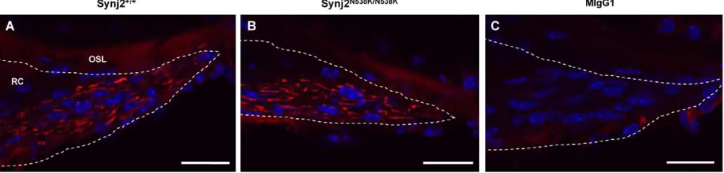 Figure 7. Synj2 but not Synj1 is expressed in the hair cells of the mouse cochlea. Synj2 expression (blue staining) within the inner and outer hair cells of Synj2 +/+ mice at 4 weeks (Panel A) and 12 weeks (Panel B), and Synj2 N538K/N538K mice at 4 weeks (