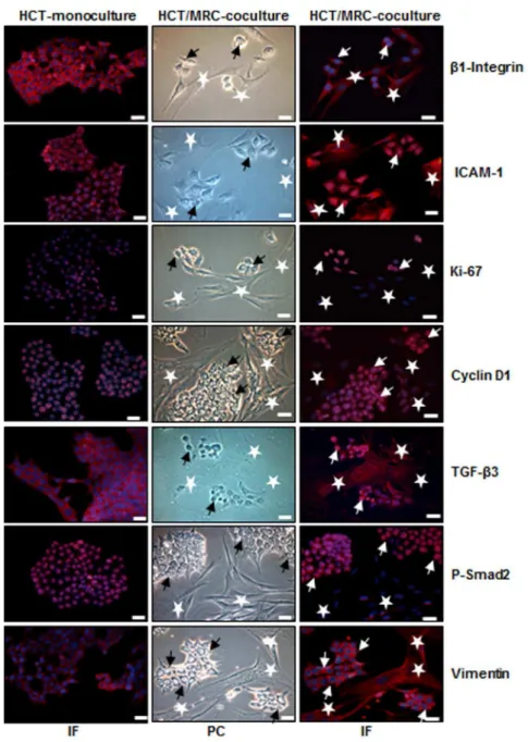 Figure 1. Intensive crosstalk between CRC and MRC-5 cells in the tumor microenvironment