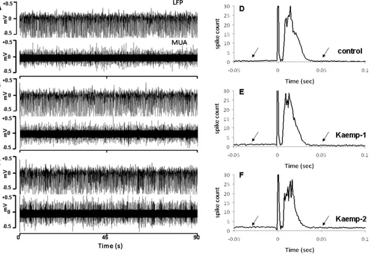 Figure 3. Kaempferol in a dose-dependent manner (Kaempferol dose-1 = 1 mg/kg; dose-2 = 2 mg/kg) increased the resting state spontaneous electrical activity in the somatosensory cortex