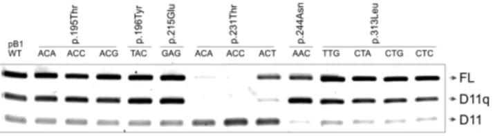 Figure 4. Minigene splicing assay of BRCA1 exon 11. A. Sequence of the critical region in exon 11 showing the deletion 1,2,3,4 (highlighted).