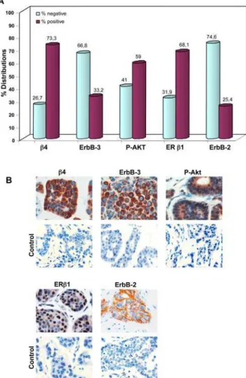 Table 2 summarizes the associations between b4 expression and biopathological factors in our series of 232 BC patients