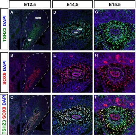 Figure 2. Comparative expression analysis of SOX9 and TSHZ3 in the developing ureter. (A–I) Immunostainings for SOX9 (red), TSHZ3 (green) on sagittal sections at E12.5, and on transverse sections of the ureter at E14.5 and E15.5