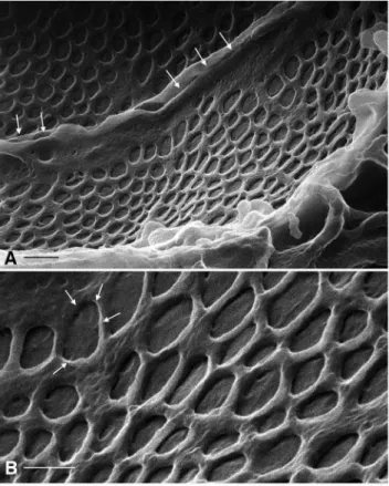 Figure 4. HIM imaging of glomerular endothelial cells. (A) Two adjacent endothelial cells from a glomerular capillary (GA-fixed, dehydrated using the extended methanol freeze-substitution protocol), imaged from the luminal side