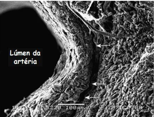 Figura  3-  Microscopia  eletrónica  de  varrimento  mostrando  esqueleto  de  colagénio  de  uma  secção  transversal  do  cordão  umbilical  humano  após  maceração  de  elementos  celulares  e  substancia  fundamental com NaOH