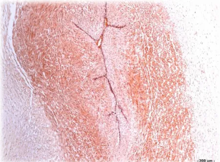 Figura 8 –Secção transversal de uma HUA com endotélio, onde se pode observar a disposição das duas  camadas de células musculares lisas vasculares, sendo a longitudinal mais interna e a outra circular