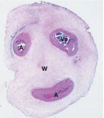 Figura 1 - Corte histológico de um cordão umbilical. A: Artérias; Ve: Veia; W: Geleia de Wharton (2) 