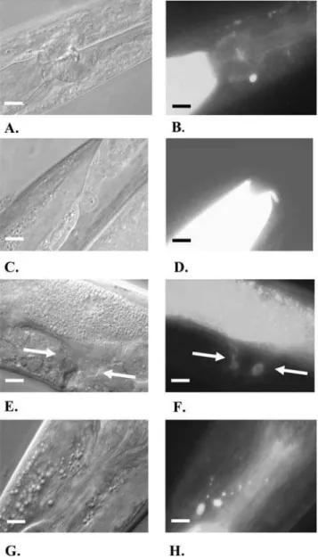 Figure 2. The Expression of elo-5Prom::GFP and elo-6Prom::GFP Constructs in Wild-Type Worms