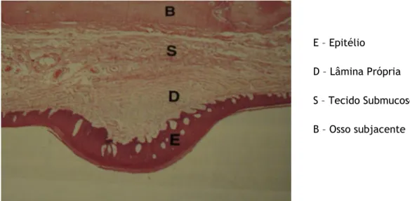 Fig. 1.2 – Epitélio Pavimentoso Estratificado da Mucosa Oral (Palato) (Adaptado de 17) 
