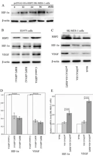 Figure 5. RBP2 stimulates the mRNA and protein expression of HIF-1 a and VEGF. (A) RBP2 up-regulated the HIF-1a protein in a  time-dependent manner under normoxic conditions