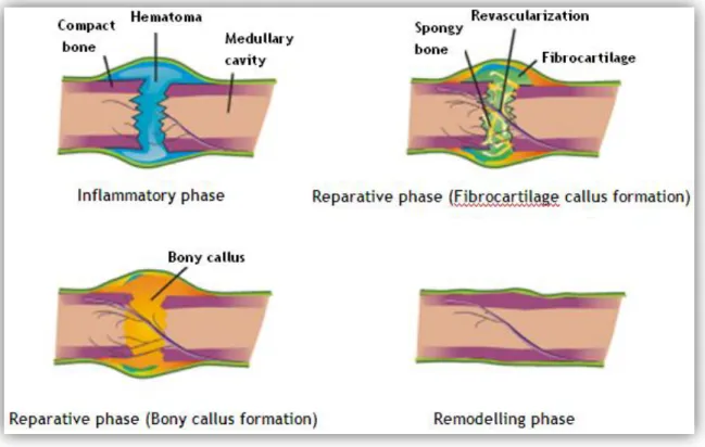 Figure 4 - Schematic representation of fracture healing (Adapted from [15]).