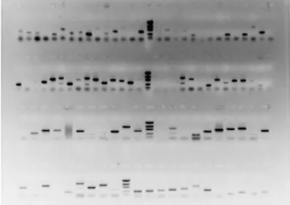 Figura 10: Análise em gel de agarose 1% dos  produtos  da  reação  de           PCR,utilizando-se  os primers PT2F2 e PT2R2