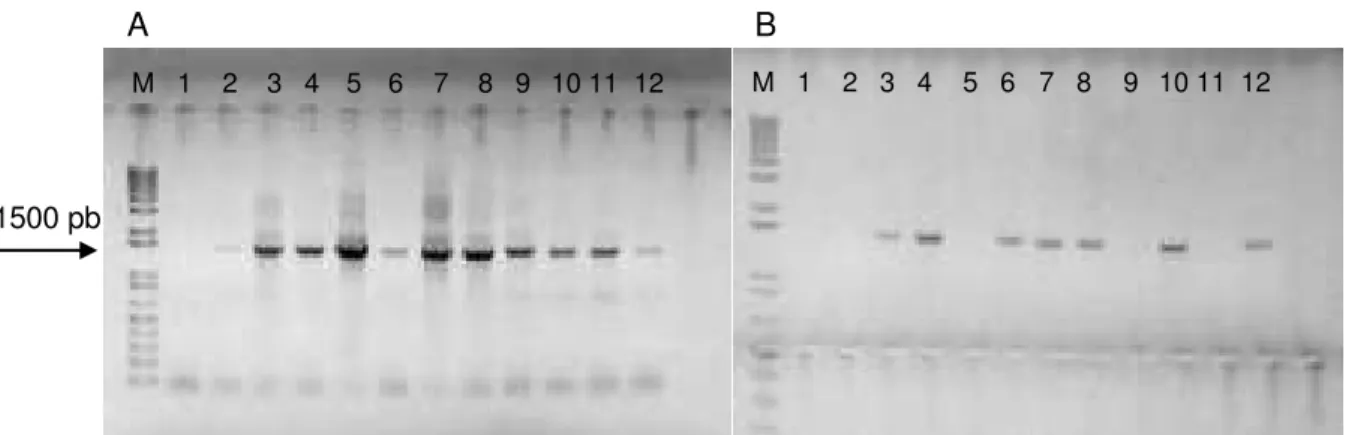 Figura  9:  Amplificação  do  gene  do  RNAr  16S  a  partir  de  DNA  obtido  de  amostras  ambientais  e  de  placas pelo método de  plate wash