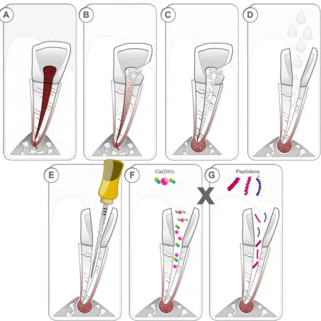 Figura  1.  Etiologia  da  lesão  perirradicular  e  princípios  do  tratamento  endodôntico