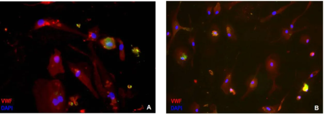 Figure 6 A. Endothelial differentiation observed in EPC isolated from CLL patient  under treatment (x400 amplification) and in (B) EPC isolated from SLL patient  without treatment (x200 amplification)