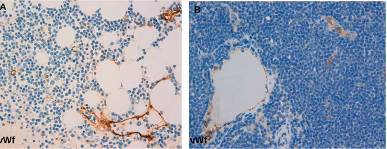 Figure 8. MVD in BM and LN of SLL patients assessed by immunohistochemistry for  vWf in paraffin-embedded sections
