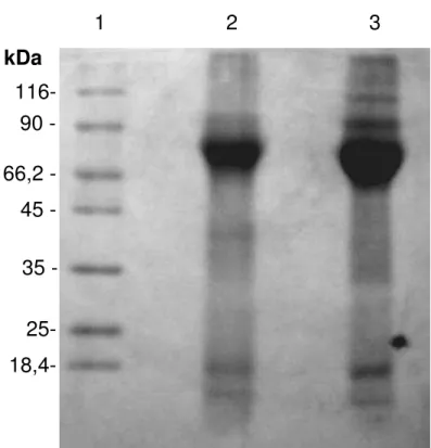 Figura 11 - SDS-PAGE 12 % das proteínas extraídas do GCF 1: Marcador de  peso  molecular;  2:  proteínas  extraídas  de  pacientes  sem  RRIE;  3:  proteínas  extraídas  de  pacientes  com  RRIE