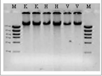 Figura 4 Gel de agarose contendo DNA genômico de A. duranensis K7988 (K), planta híbrida (H) e  A