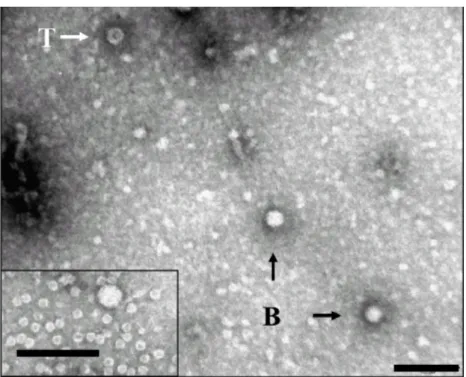 Figura 6 Microscopia eletrônica da purificação de CSDaV de folhas  infectadas (Maccheroni et al., 2005)