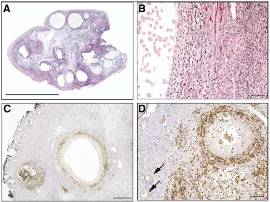 Figura 8.  Fotos de microscopia de ovário humano.  A – Ovário corado com hematoxilina  e eosina mostra múltiplos folículos antrais (barra = 1 cm)