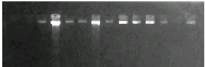 Figura 12. Gel para avaliar concentração de DNA das 3 amostras do estudo. Da direita para 