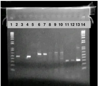 Figura 13. Gel de agarose 1% para visualização dos produtos de PCR. Foram colocados  produtos da PCR e os marcadores em 14 poços da direita para esquerda, como se segue: 1-  Marcador 1Kb plus, 2- prim A-B paciente, 3- prim A-B mãe, 4- prim A-B pai, 5- prim
