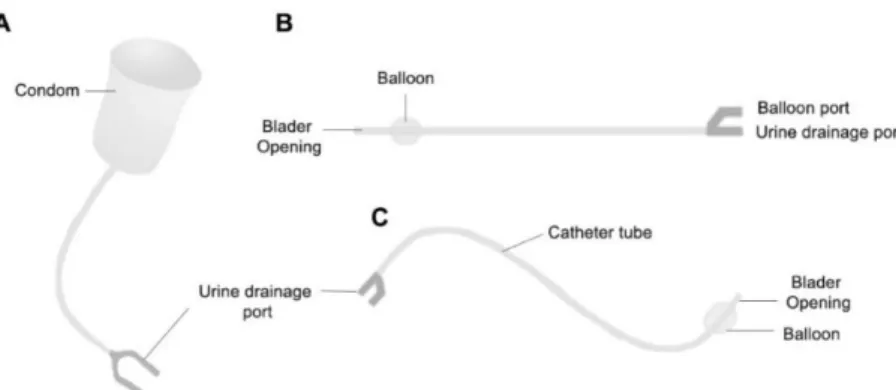 Figure 3 Types of urinary catheters. (A) Used in masculine catheterization for ~1 week  (B) Intermittent or short-term catheterization (C) Foley or long-term use catheter