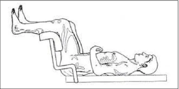 Figura 8 - Posição de litotomia ou ginecológica. 