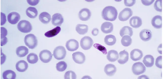 Figura  3.  Esfregaço  de sangue  humano  infetado  com  o  parasita  da  malária,  P