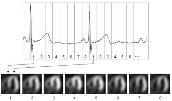 Figura 4 – Representação da sincronização da aquisição de dados com o sinal de electrocardiograma  numa imagem gated (2)