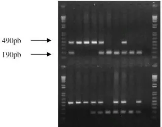 Figura  4.  Imagem  da  eletroforese  em  gel  de  agarose  1%,  realizada  para  verificação  da  eficácia da PCR e identificação dos genótipos