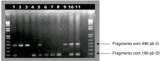 Figura 5. Identificação dos genótipos pelos produtos da PCR visualizados em gel de agarose (1%) para 11 voluntários