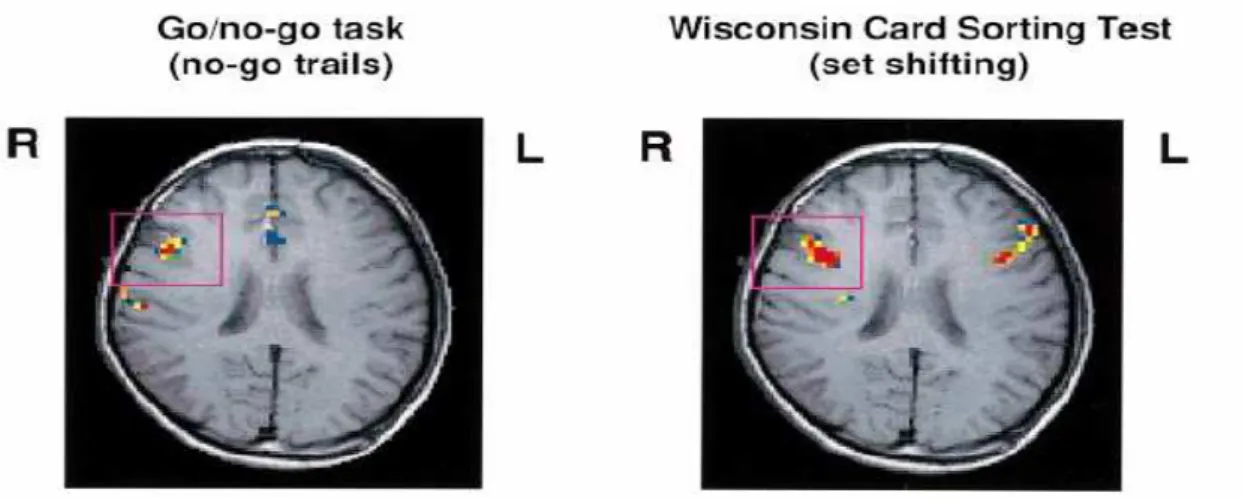 Figura 9: Imagens de fMRI em testes aplicados por KONISHI et al. 1999. 