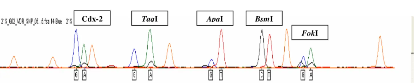 Figura 05. Eletroferograma de produtos de minisequenciamento para os locos Cdx2, TaqI, ApaI, BsmI e FokI