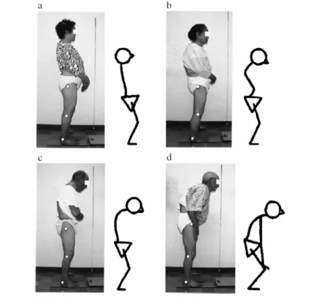 Figura 4 – Classificação de deformidades posturais senis. 