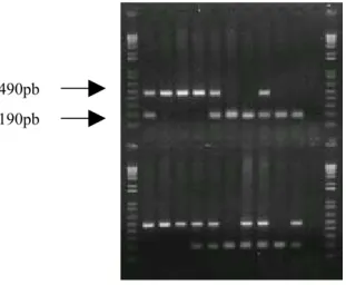 Figura 4.  Eletroforese em gel  de agarose  1%, realizada para  verificação da eficácia da PCR  e identificação dos genótipos.