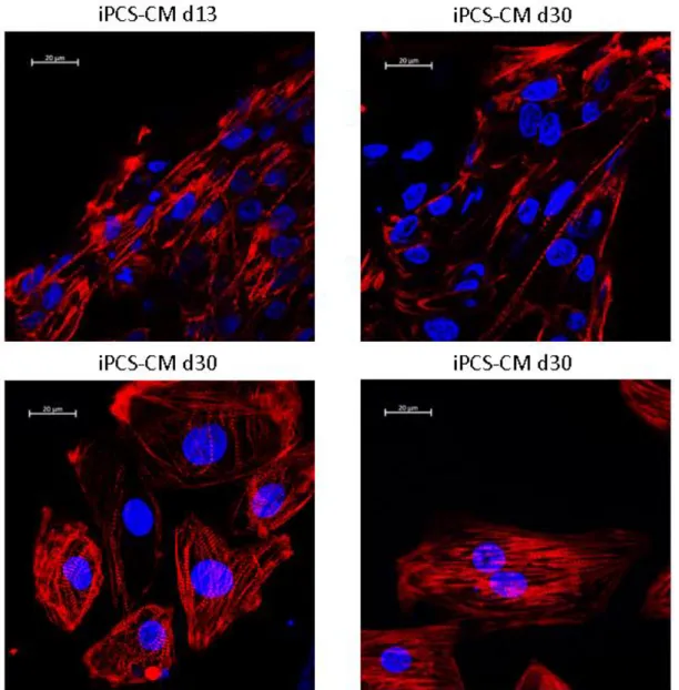 Figure  10:  Immunofluorescent  of  iPSC-CM  at  day  13  and  30  of  differentiation  stained  using  DAPI  and  a  TNNT2  specific antibody