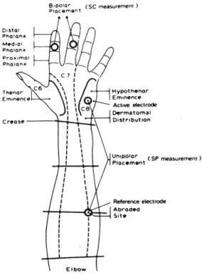 Figure 3 | Placement of the electrodes on the midphalangeal sites 