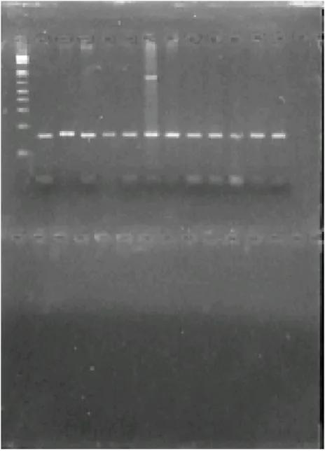 FIGURA 11: Fragmentos de DNA  separados por eletroforese em  gel de agarose. 